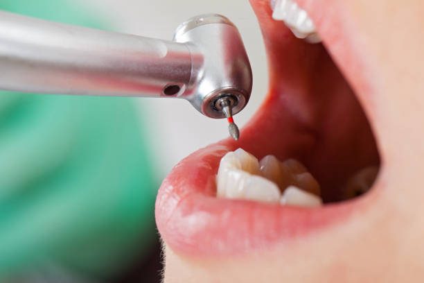 Best Emergency Root Canal Therapy in Wetumka, OK
